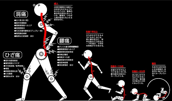 集英社 健康百科「脊椎の変化と腰痛」